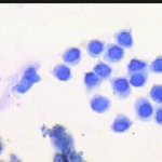 Κύτταρα ενδομητρίου